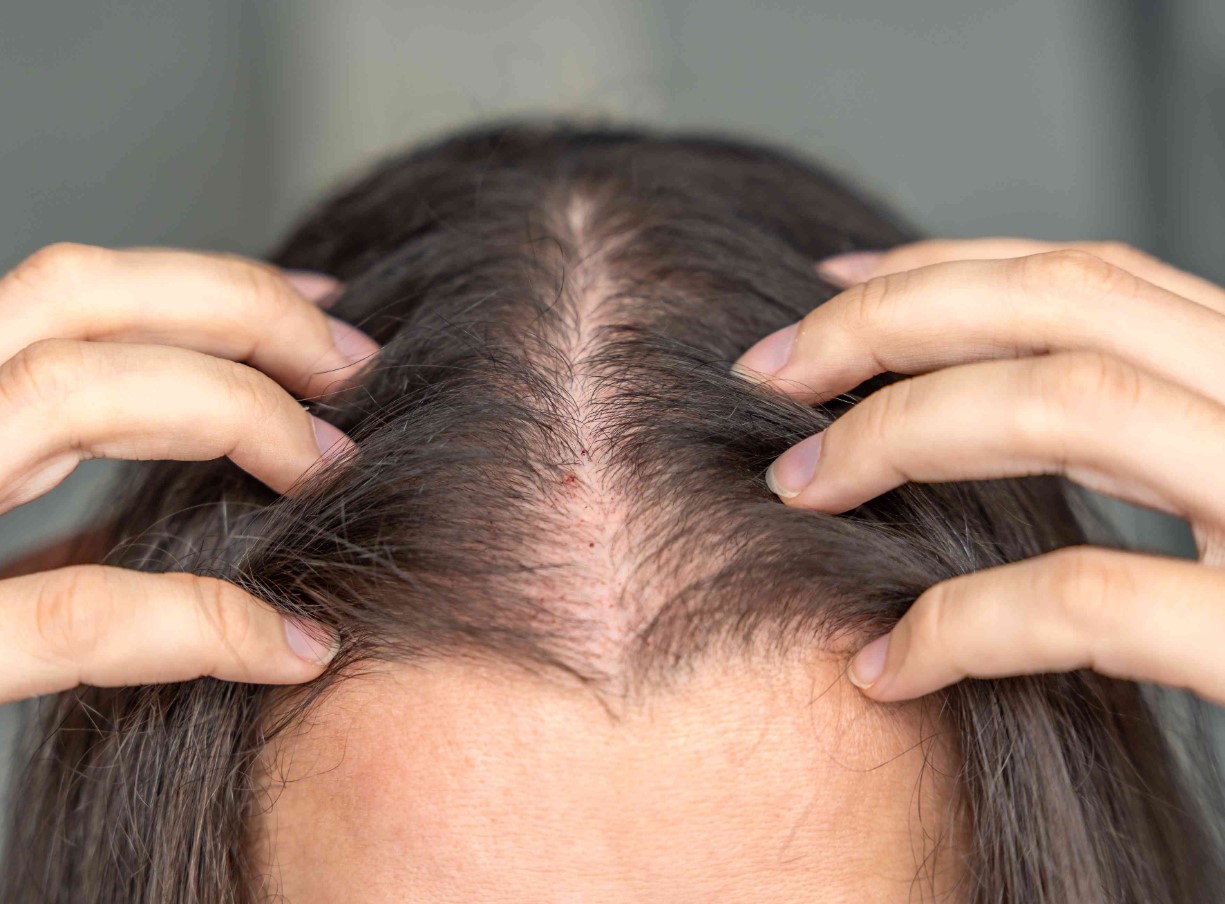 Uus lootus juuste väljalangemise vastu pärast 30 aastat vaikust