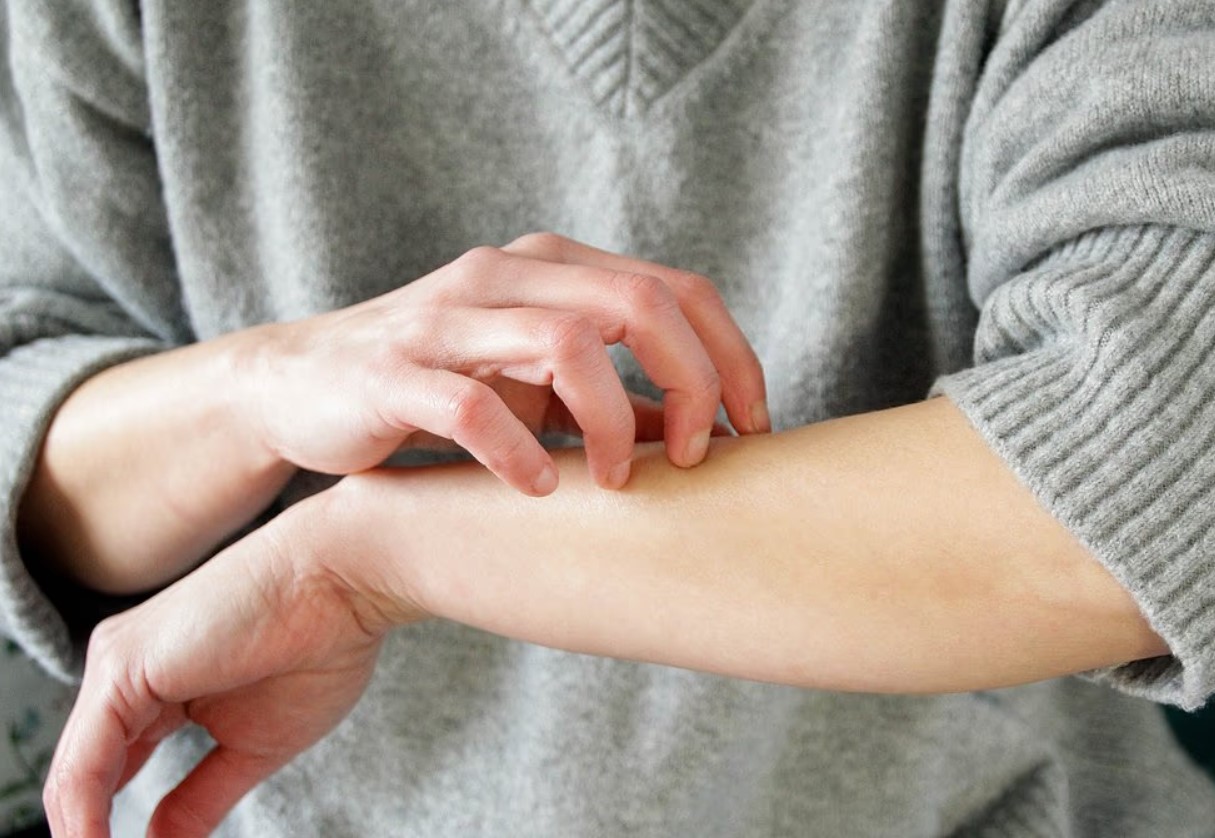 Kas oled külma suhtes allergiline? Paljud ei saa sellest ise arugi