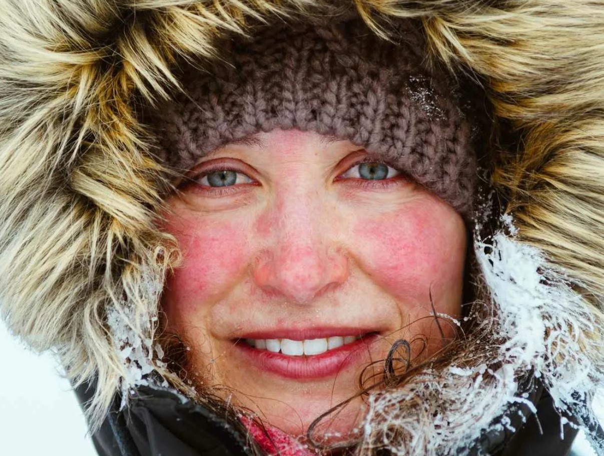 Kas oled külma suhtes allergiline? Paljud ei saa sellest ise arugi